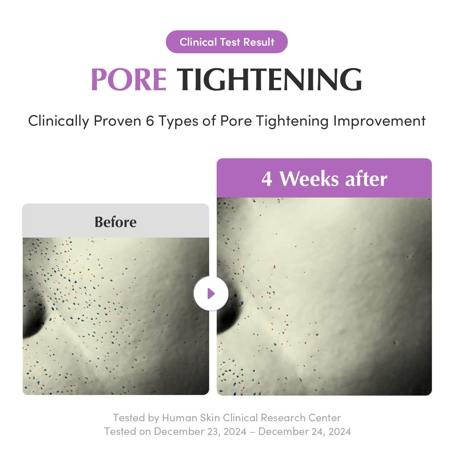 Purple PDRN Pore Minimizing Serum - image 5