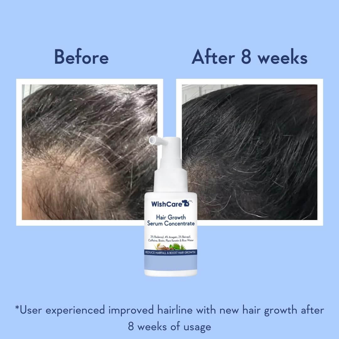 Hair Growth Serum Concentrate - image 4