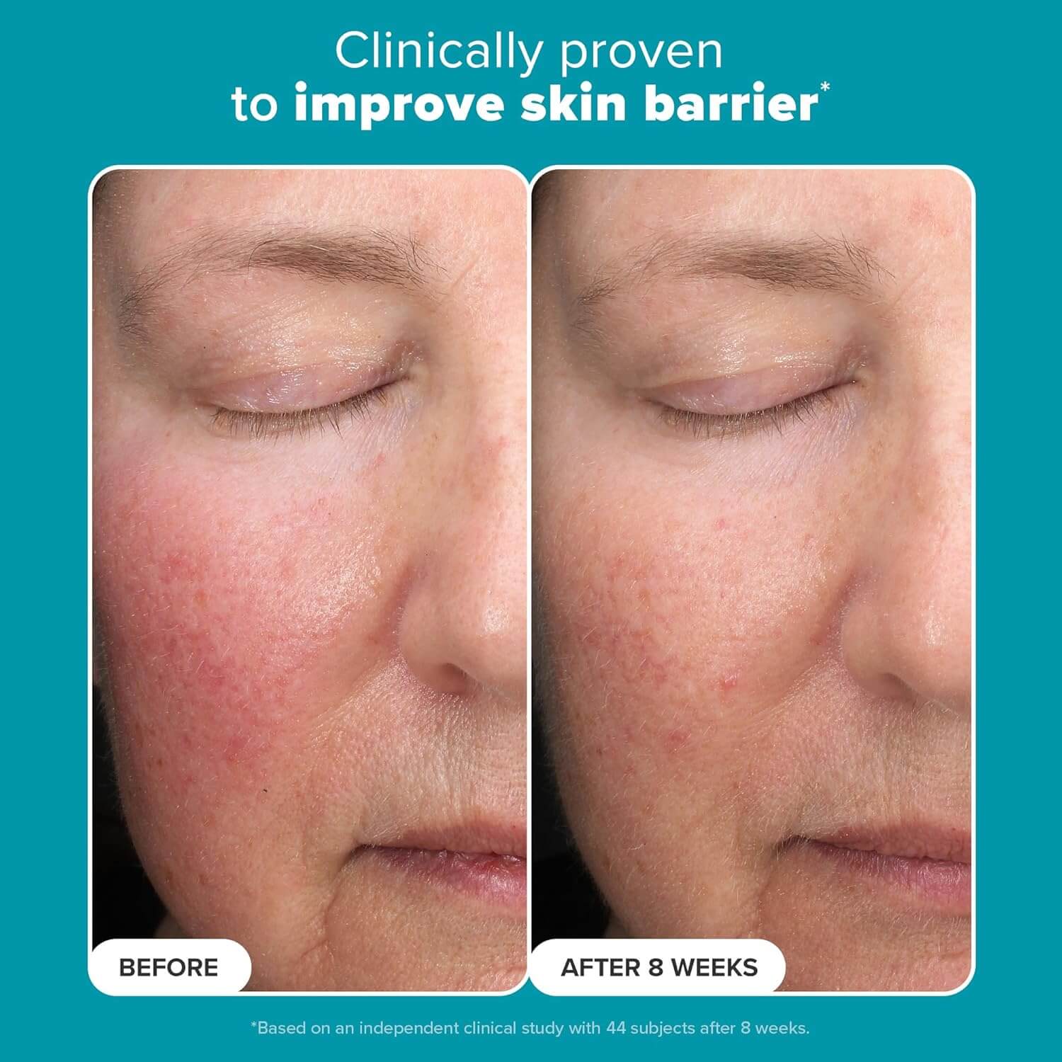 6% Mandelic + 2% Lactic Acid AHA Liquid Exfoliant - image 6