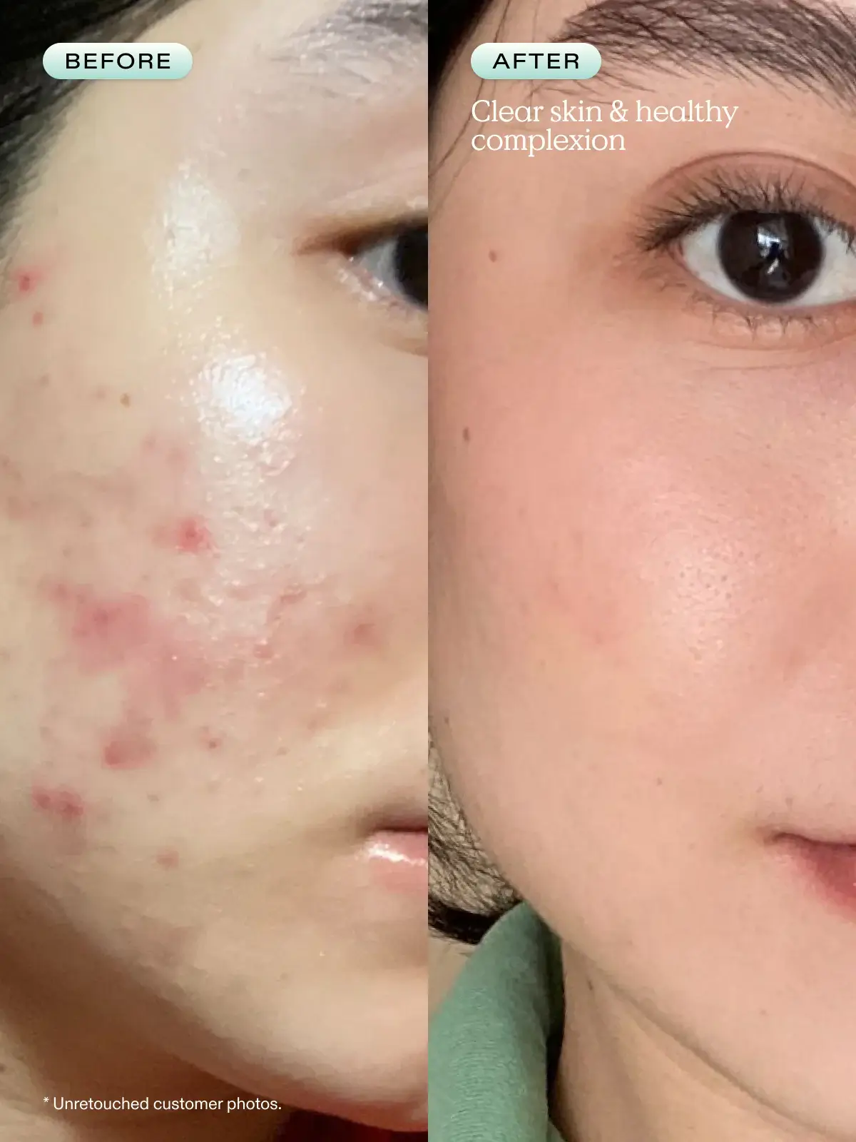 Great Barrier Relief  - image 4