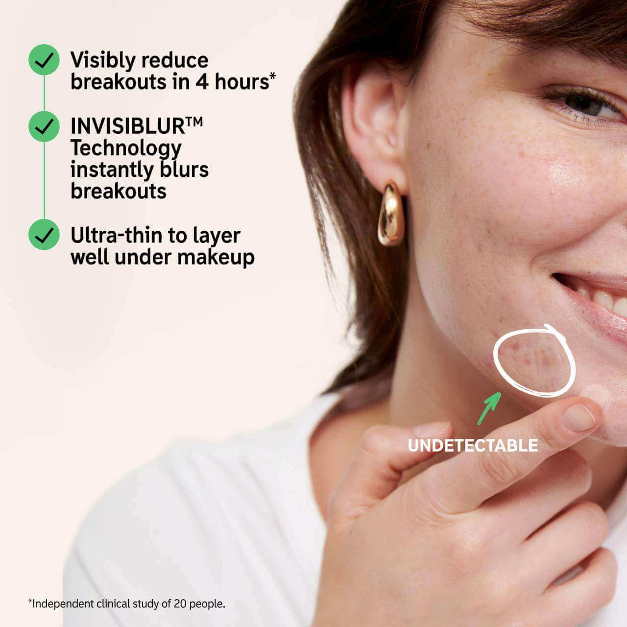 Hydrocolloid Invisible Pimple Patches - image 5