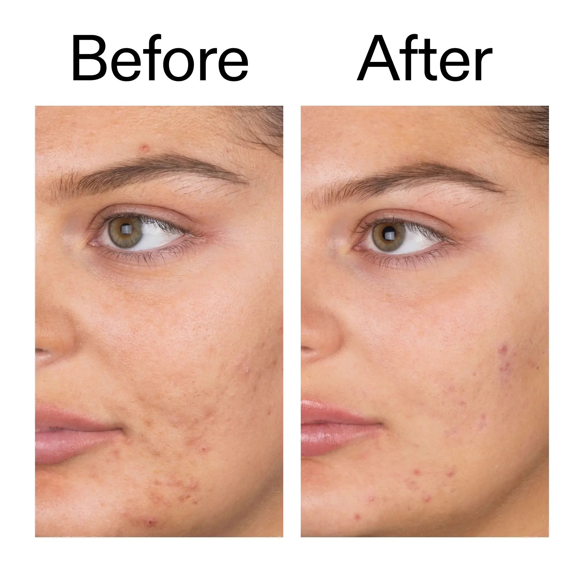 Salicylic Acid cleanser - image 8