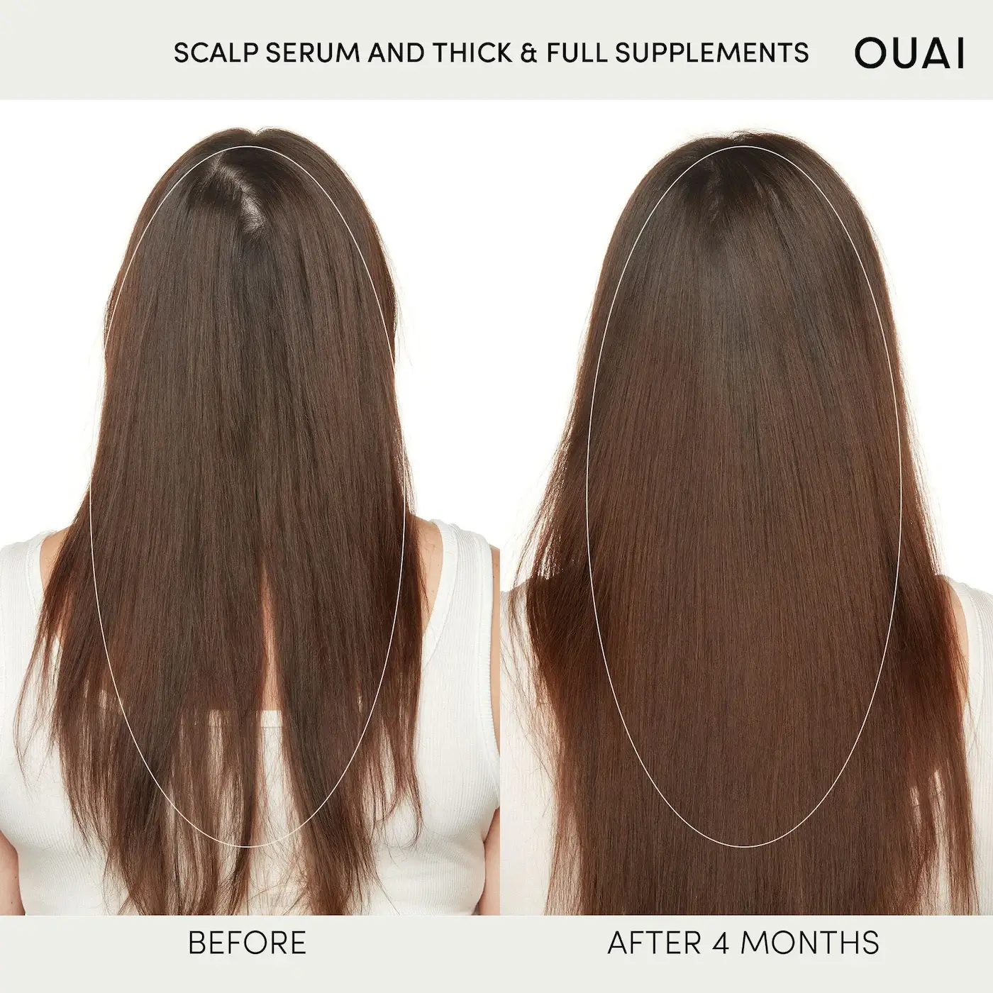 Scalp Serum - image 5