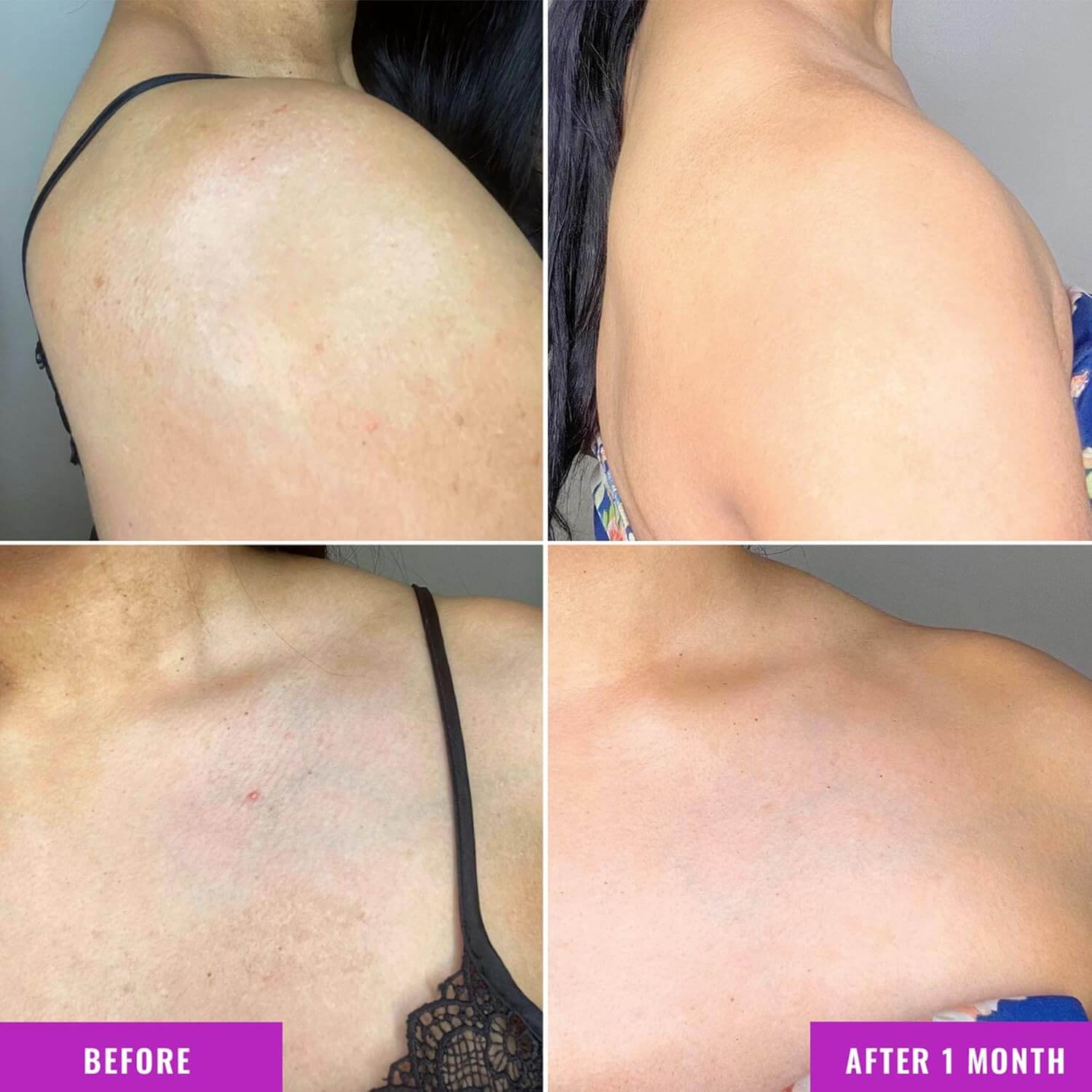 Discoloration Correcting Body Treatment  - image 4