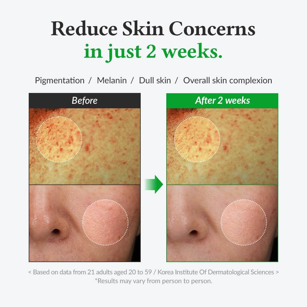 Gentle Vitamin C Serum - image 11