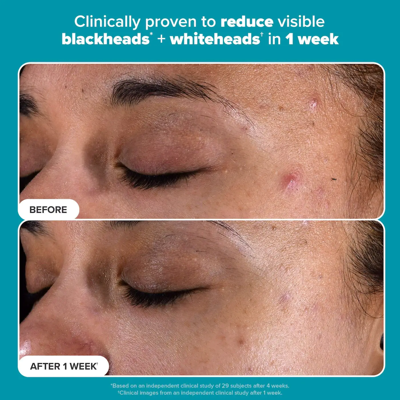 Skin Perfecting 2% BHA Liquid Exfoliant - image 8