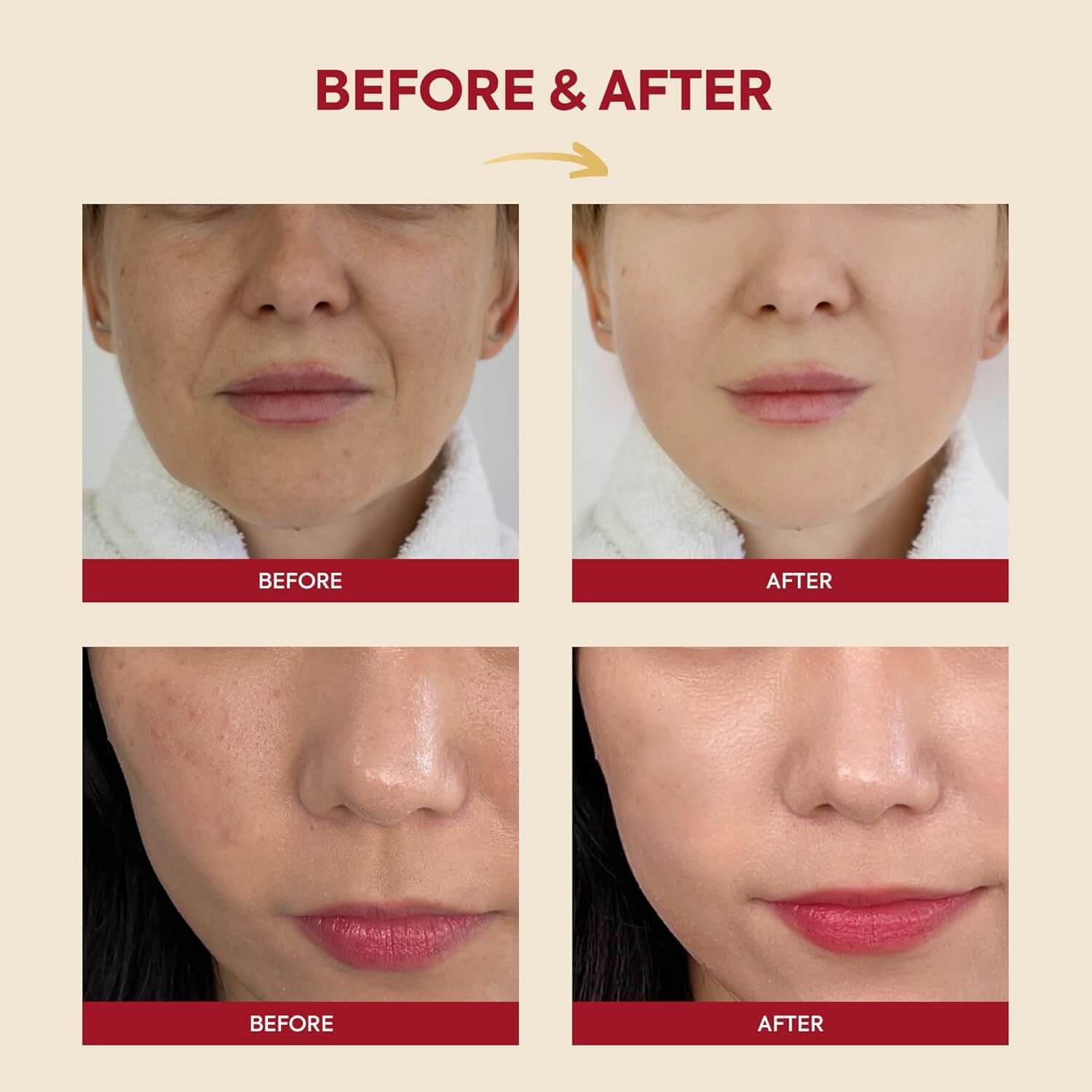 SEOUL 1988 Essence : Snail Mucin 97% + Rice - image 6