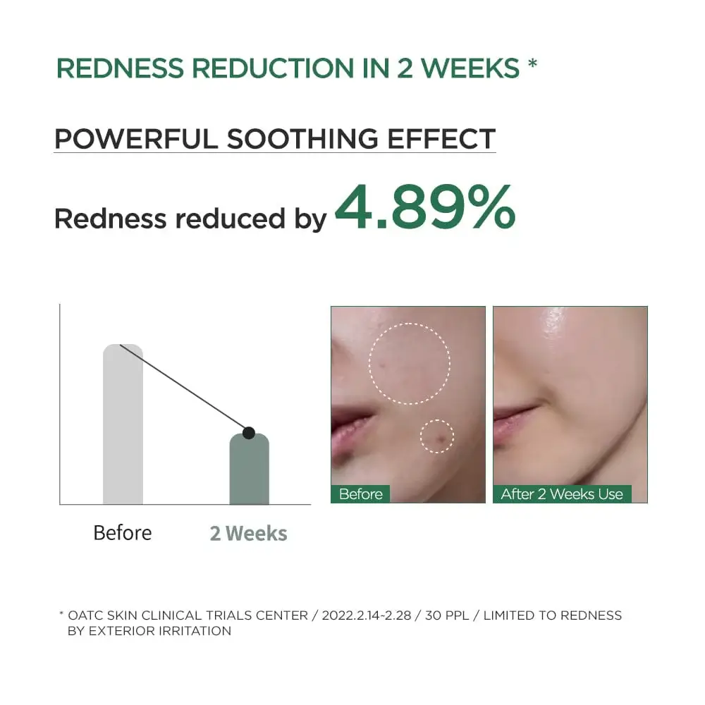 Heartleaf 80% Moisture Soothing Ampoule - image 5