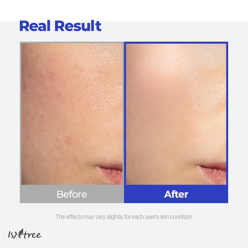 Hyaluronic Acid Aqua Gel Cream - image 7