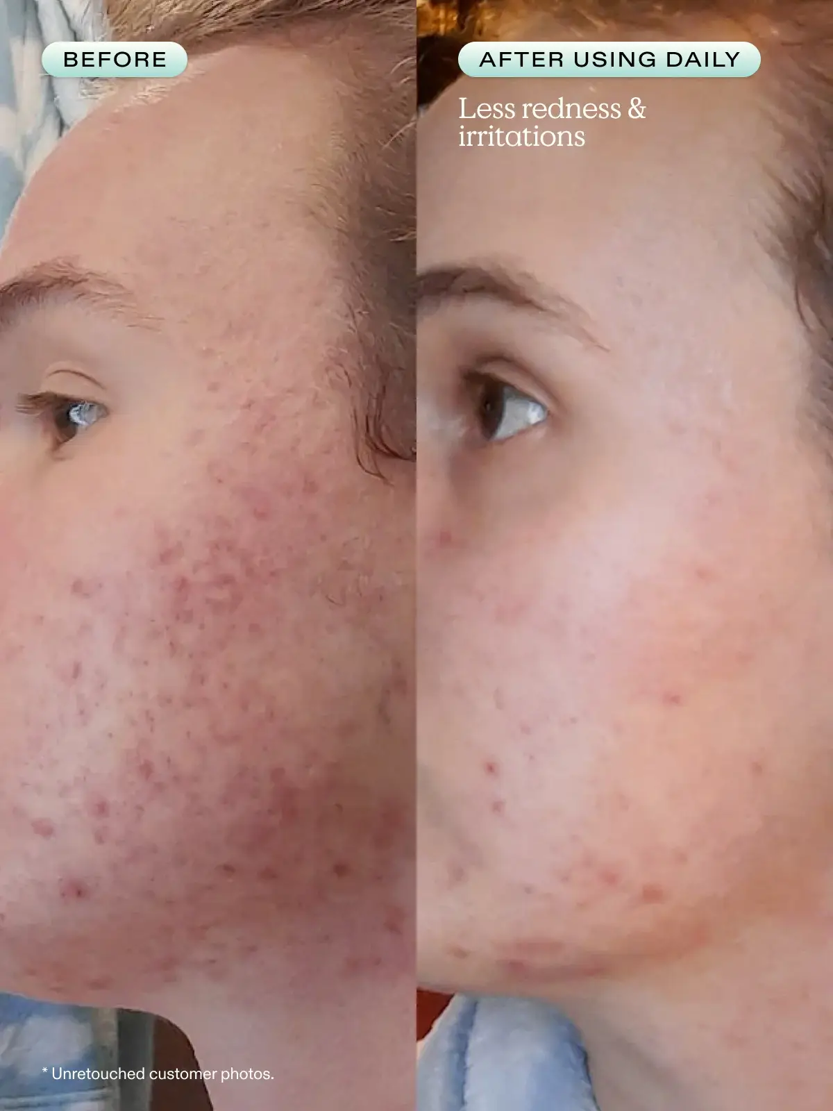 Great Barrier Relief  - image 3