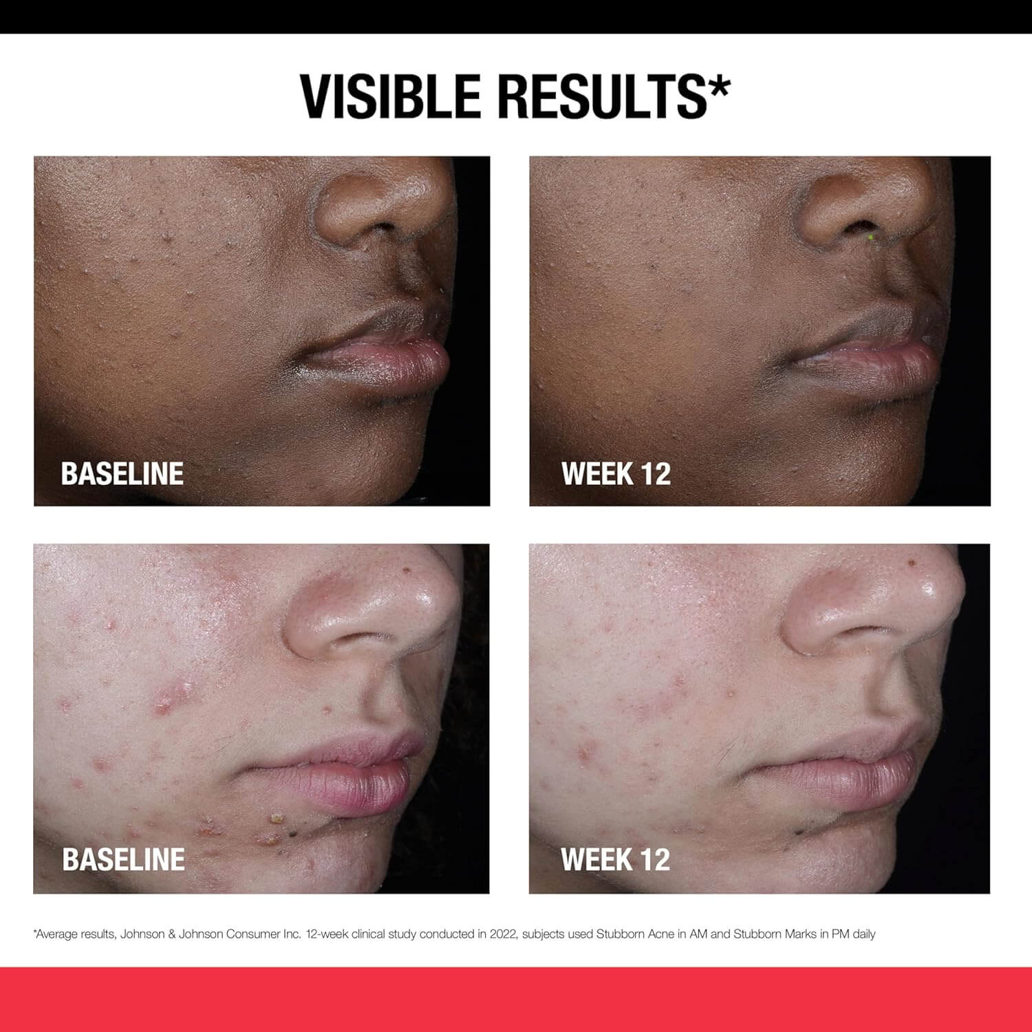 Stubborn Marks PM Treatment - image 5