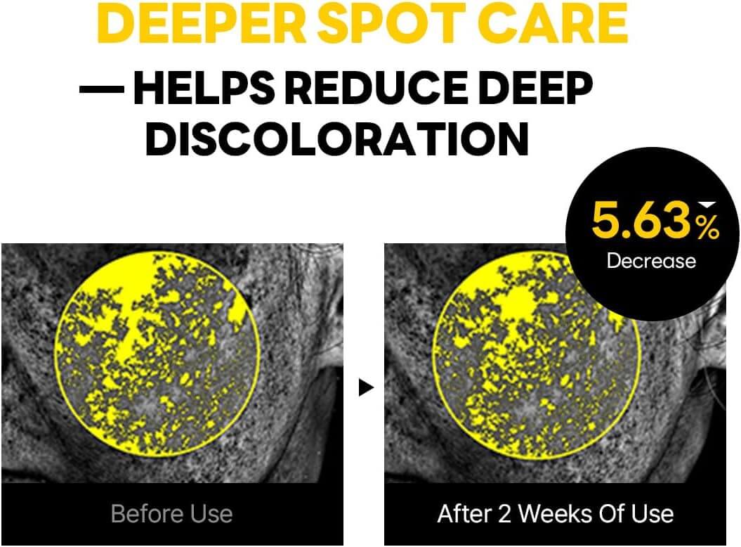 Vita Niacinamide Dark Spot Cream - image 7