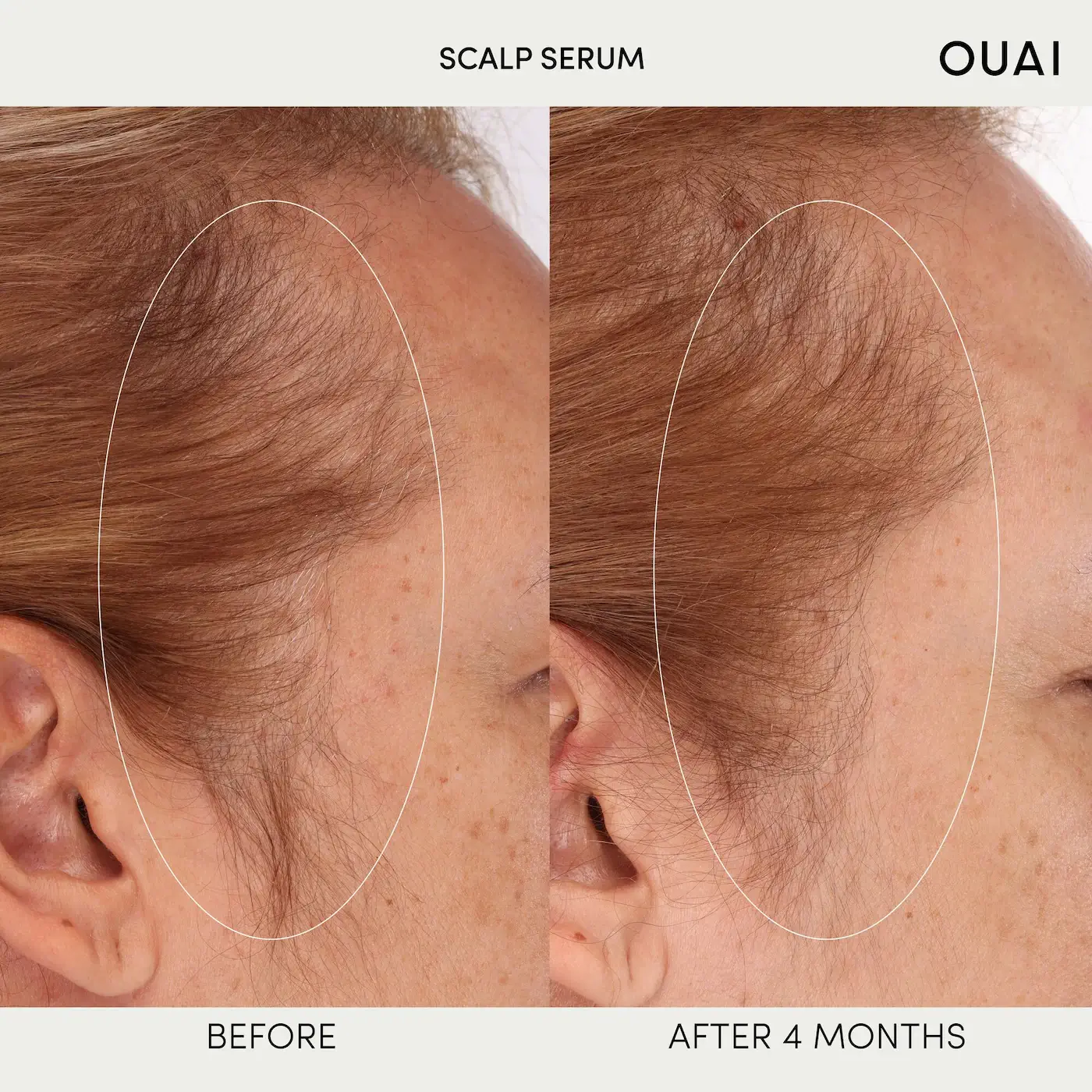Scalp Serum - image 6