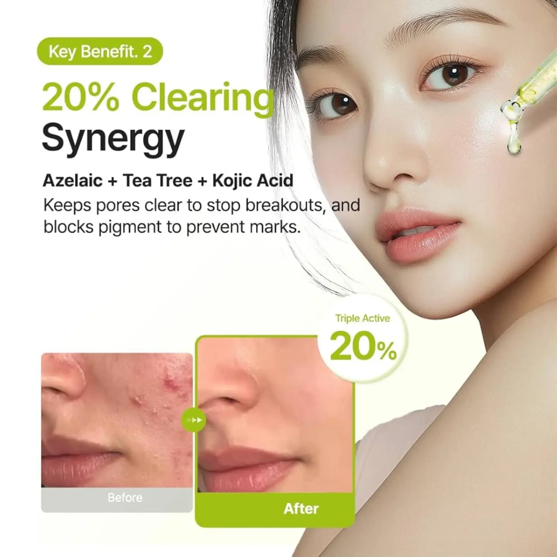 Azelaic Acid 10 Kojic Tea Tree Serum - image 4