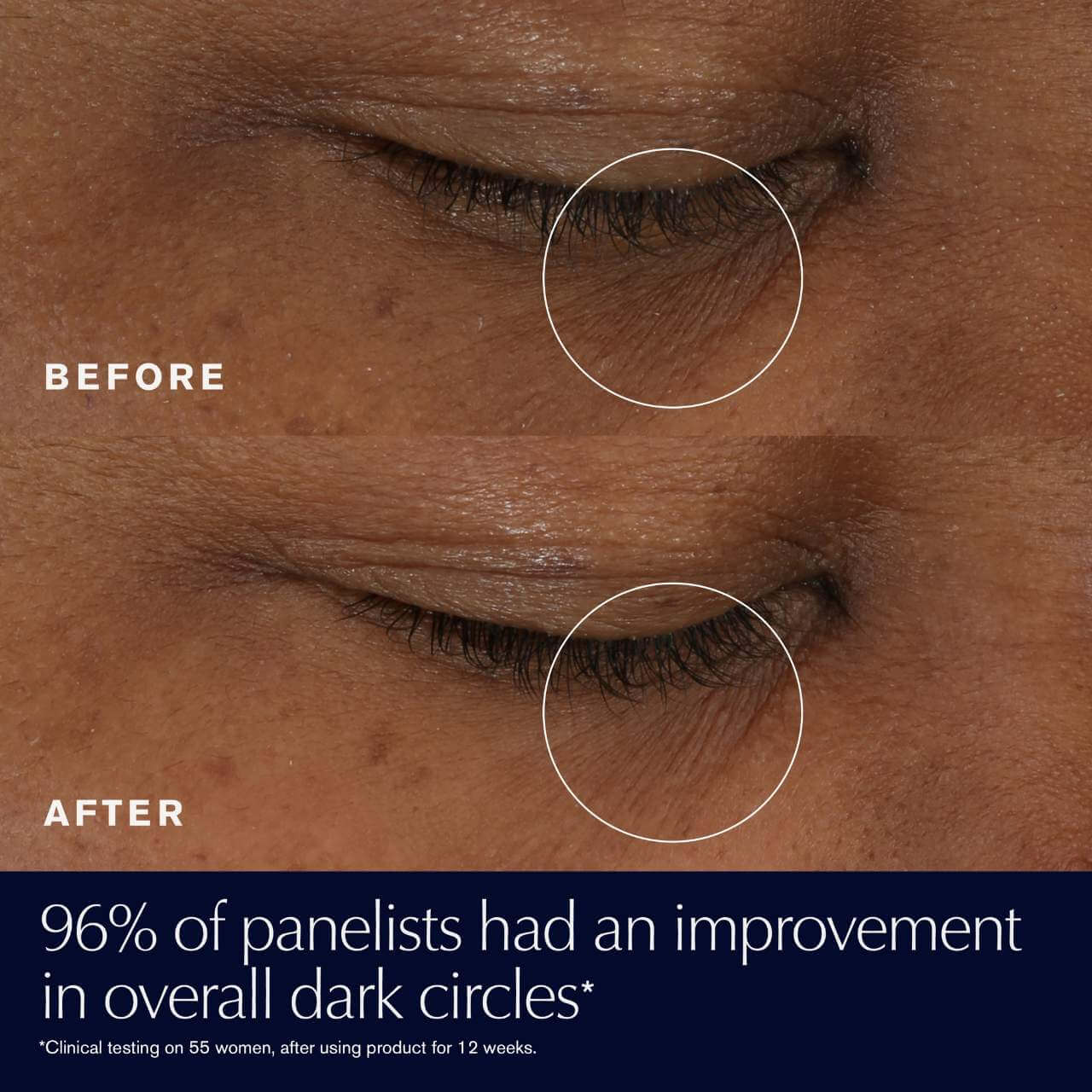 Advanced Night Repair Eye Supercharged Gel-Creme - image 3