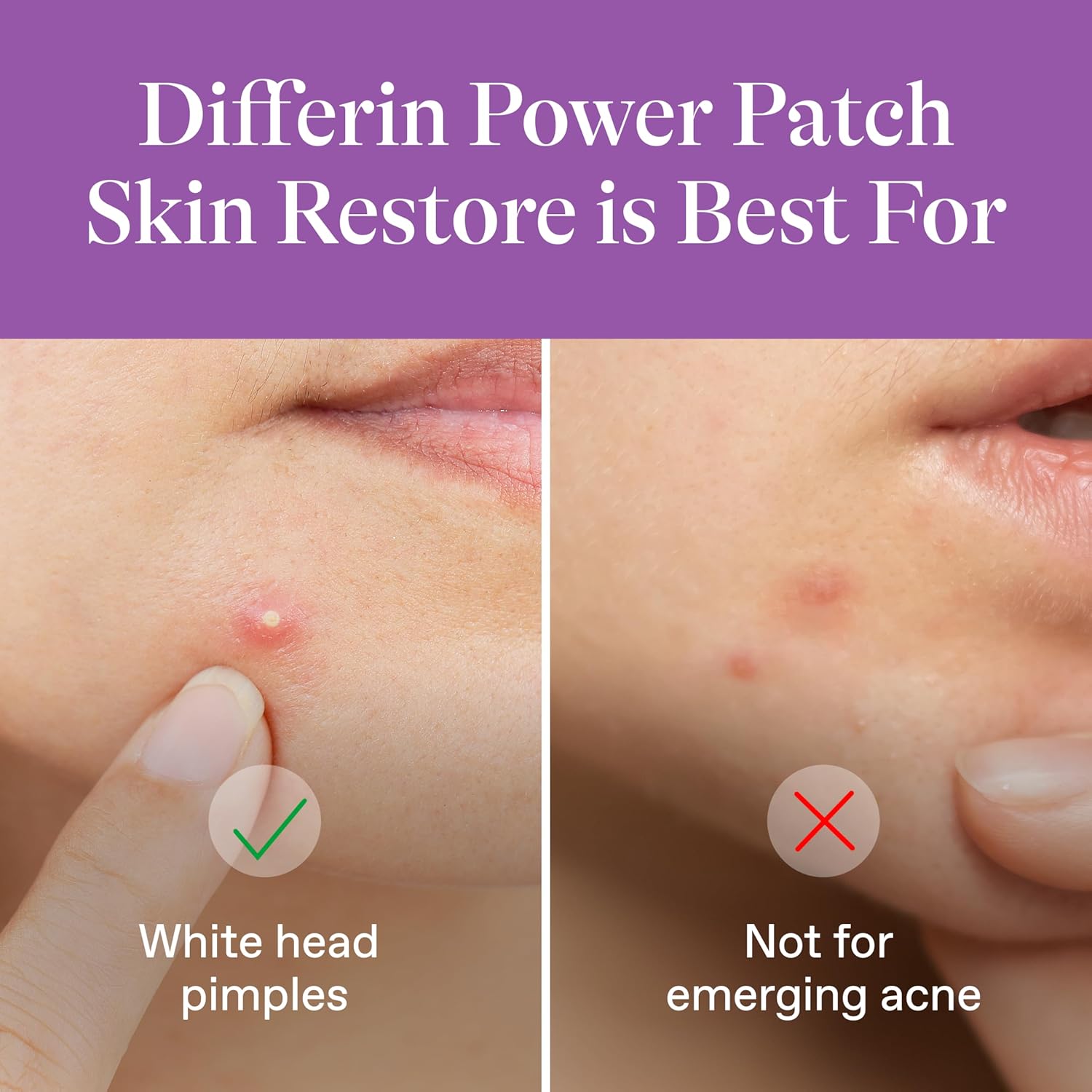 Power Patch Skin Restore - image 5