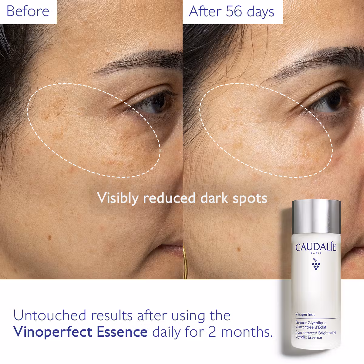 Vinoperfect Concentrated Brightening Glycolic Essence - image 4