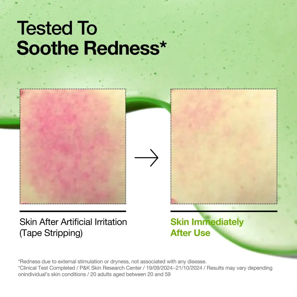  Azelaic Acid 10 Hyaluron Redness Soothing Serum - image 4