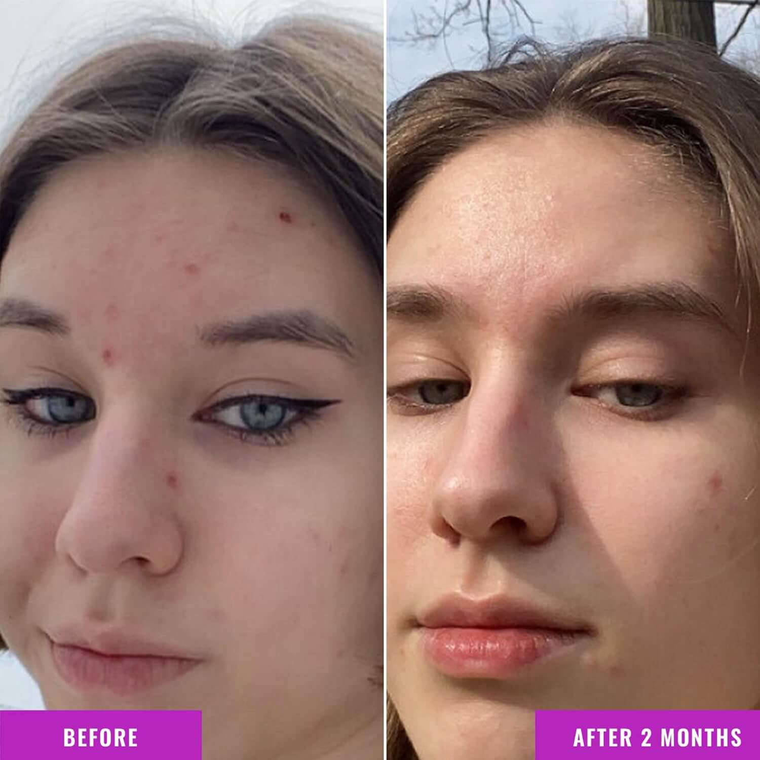 Niacinamide Serum - image 5