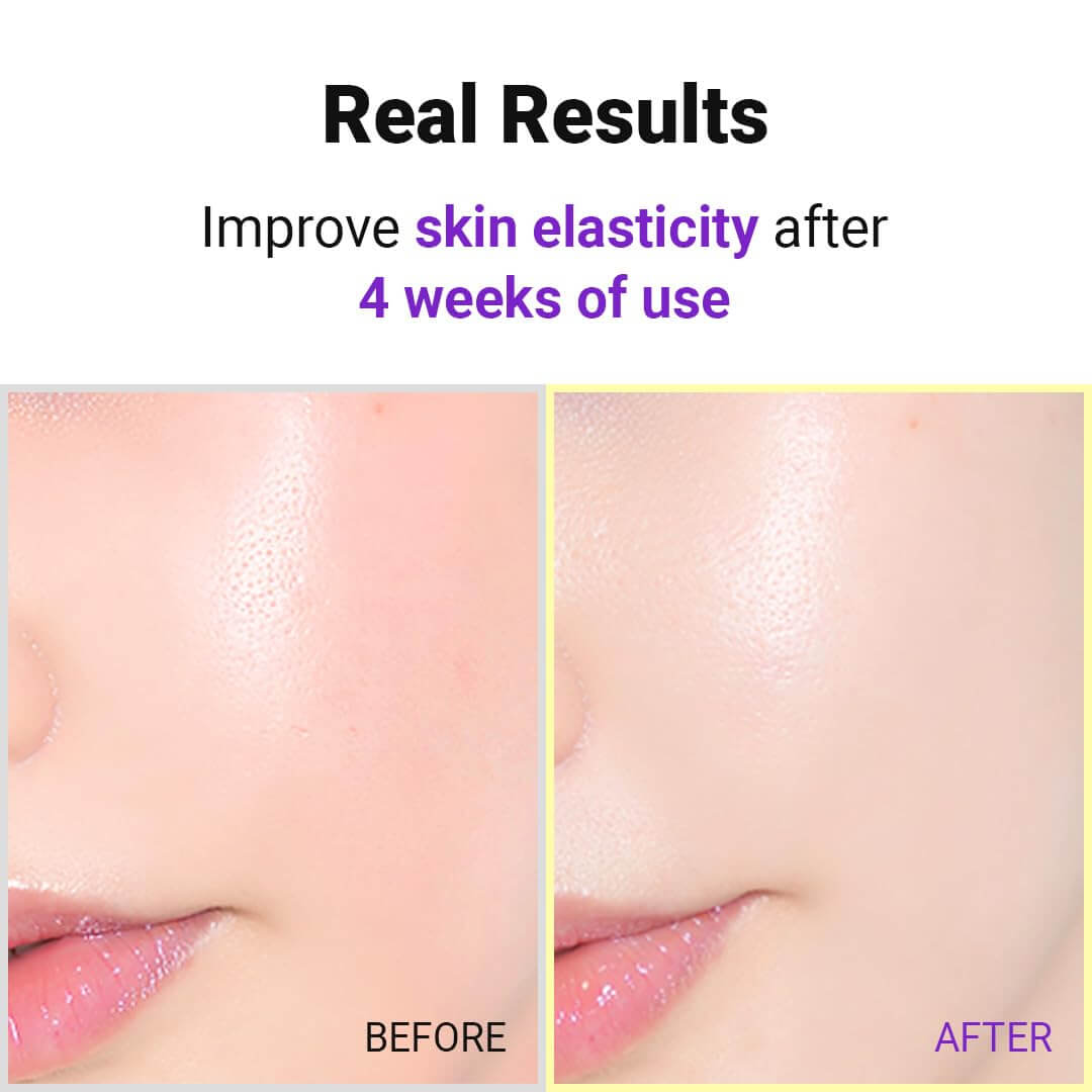 Hyper Retinol EX 1.0 Serum - image 6