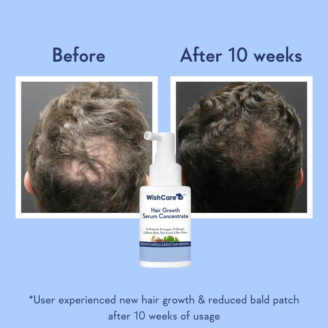 Hair Growth Serum Concentrate - image 3