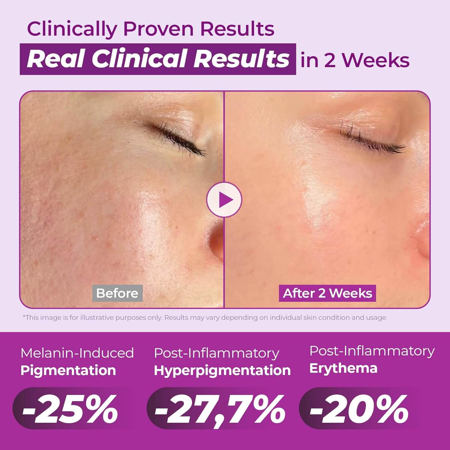 Niacinamide 20% Serum - image 8