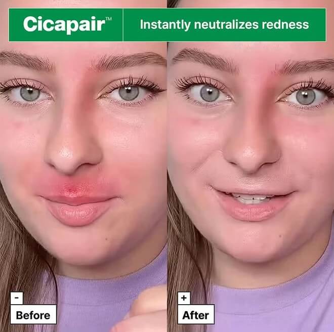 Cicapair Tiger Grass Color Correcting Treatment SPF22 - image 3