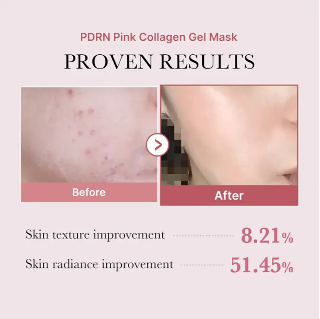 PDRN Pink Collagen Gel Mask 4ea - image 7