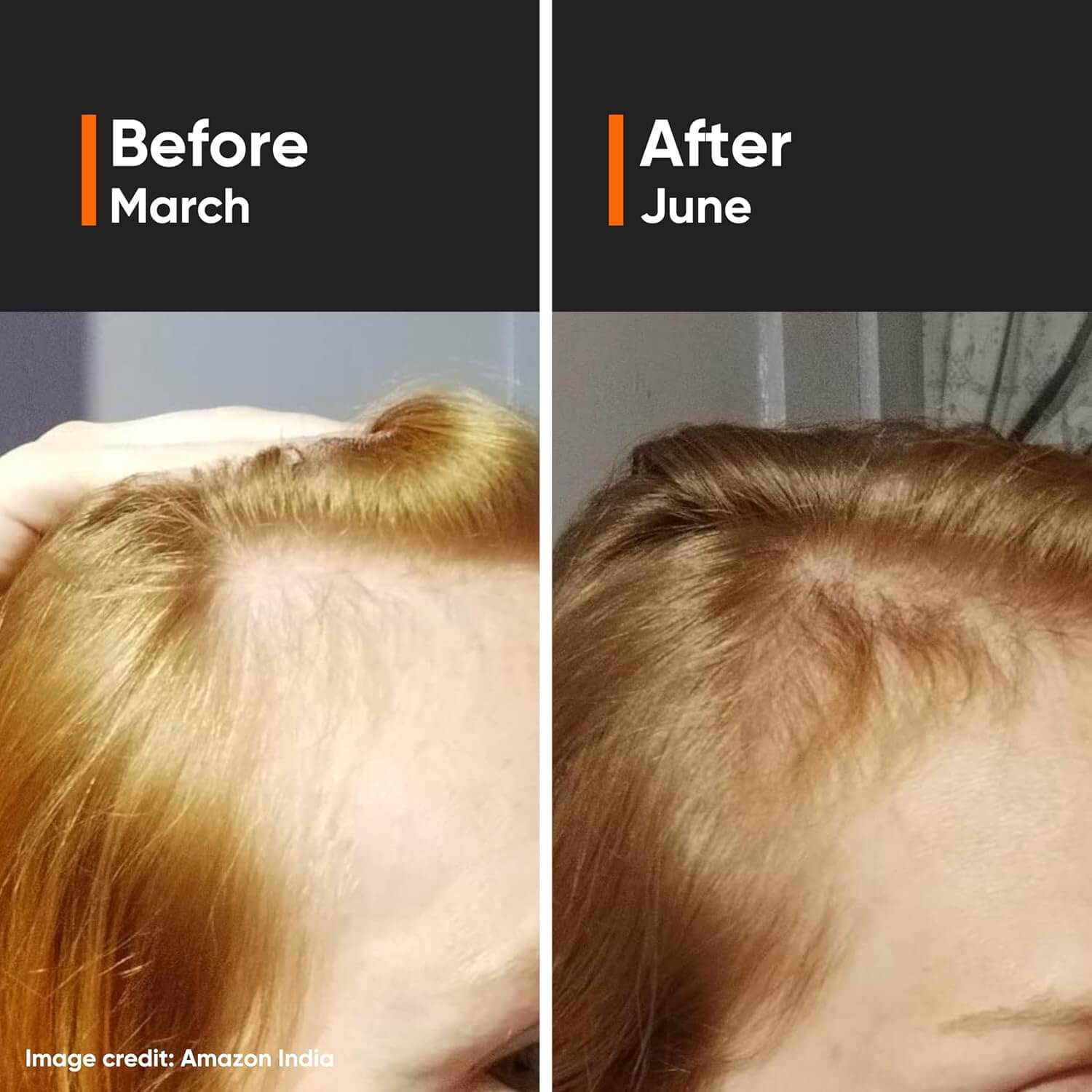 Hair Growth Actives 18% Hair Serum - image 8