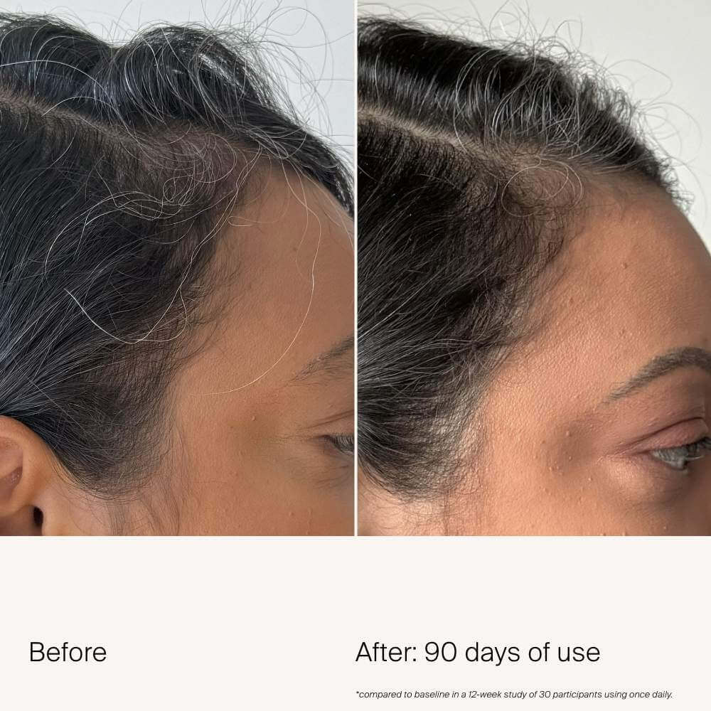 Scalp Care Density Serum - image 6