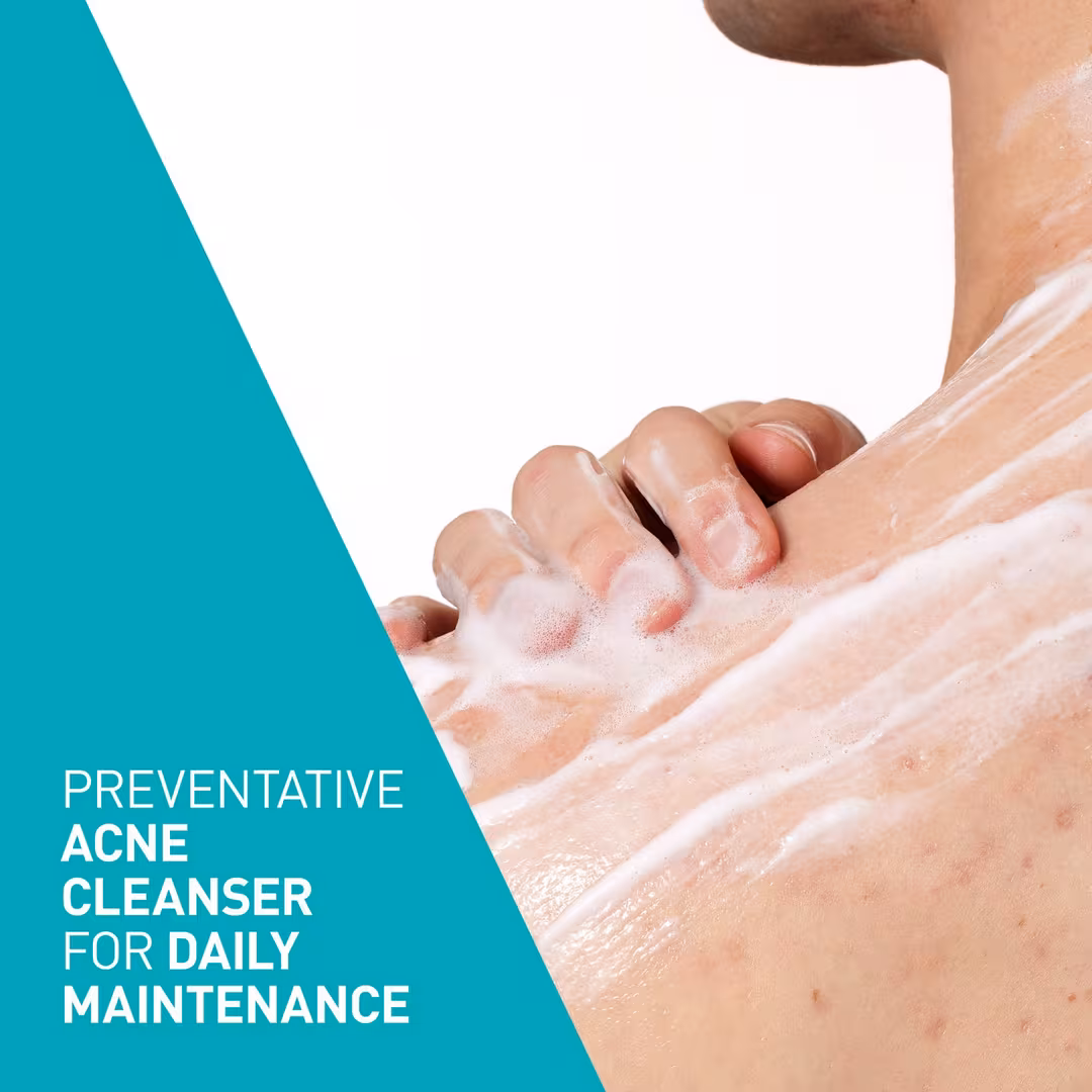 Acne Foaming Cream Cleanser - image 6