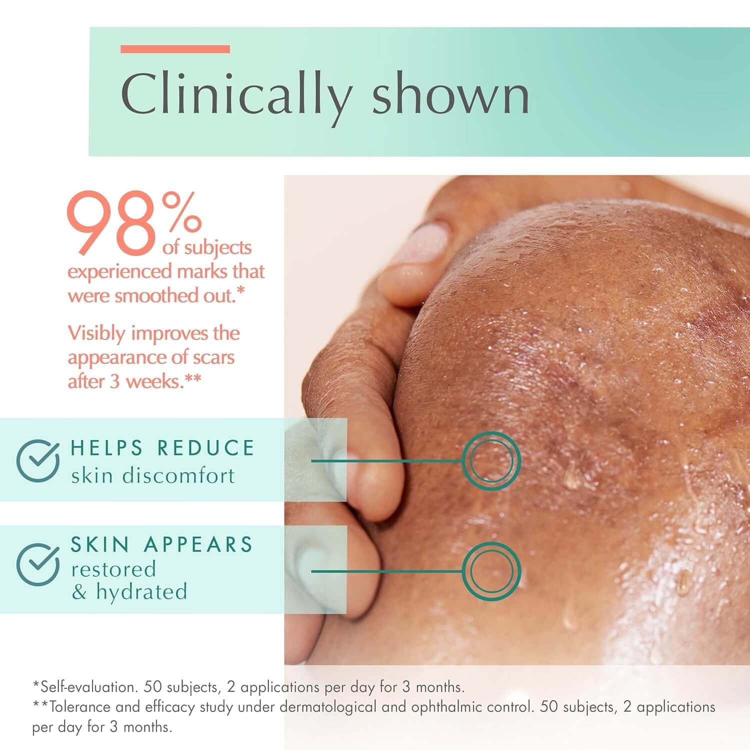 Cicalfate+ Scar Gel - image 5