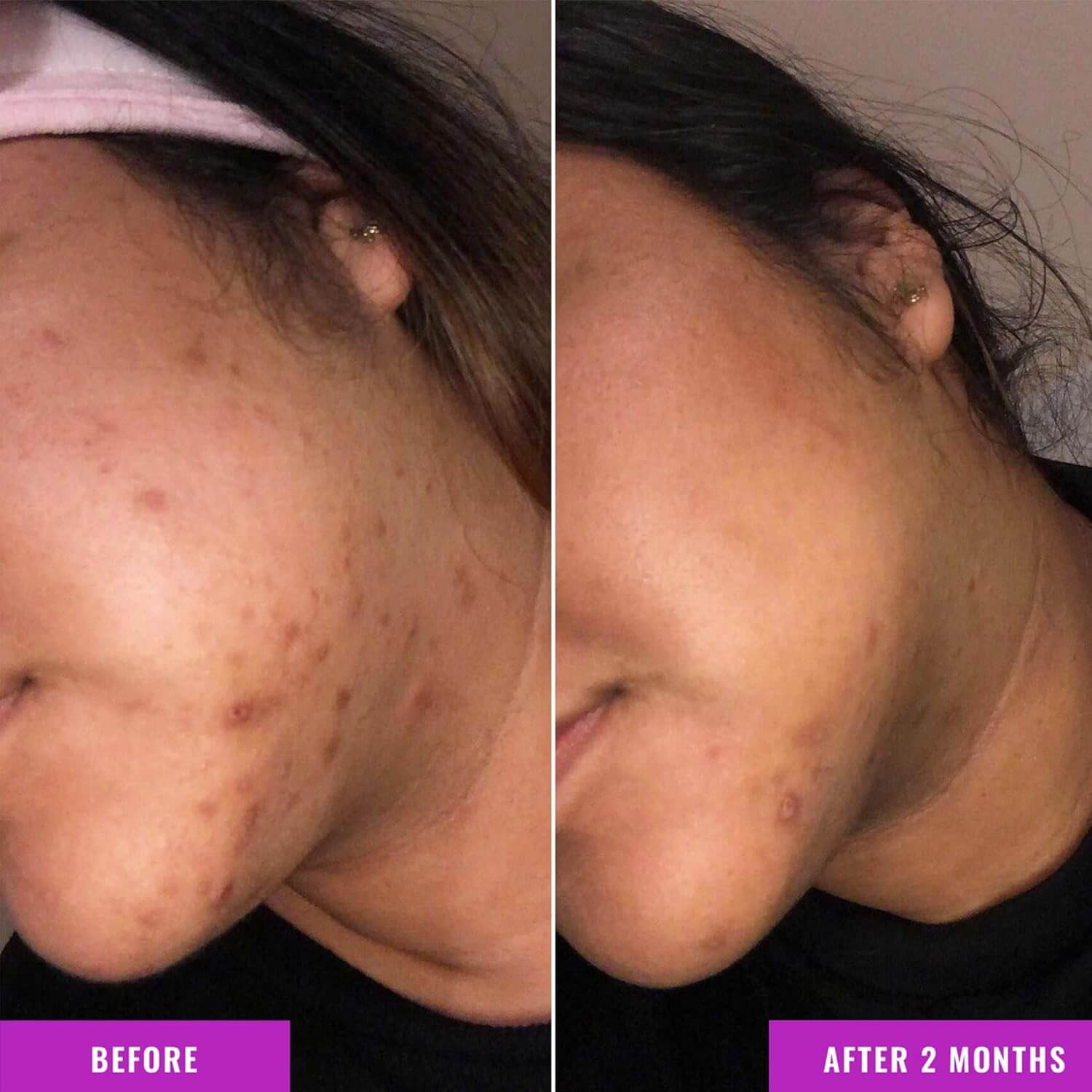 Discoloration Correcting Serum - image 5