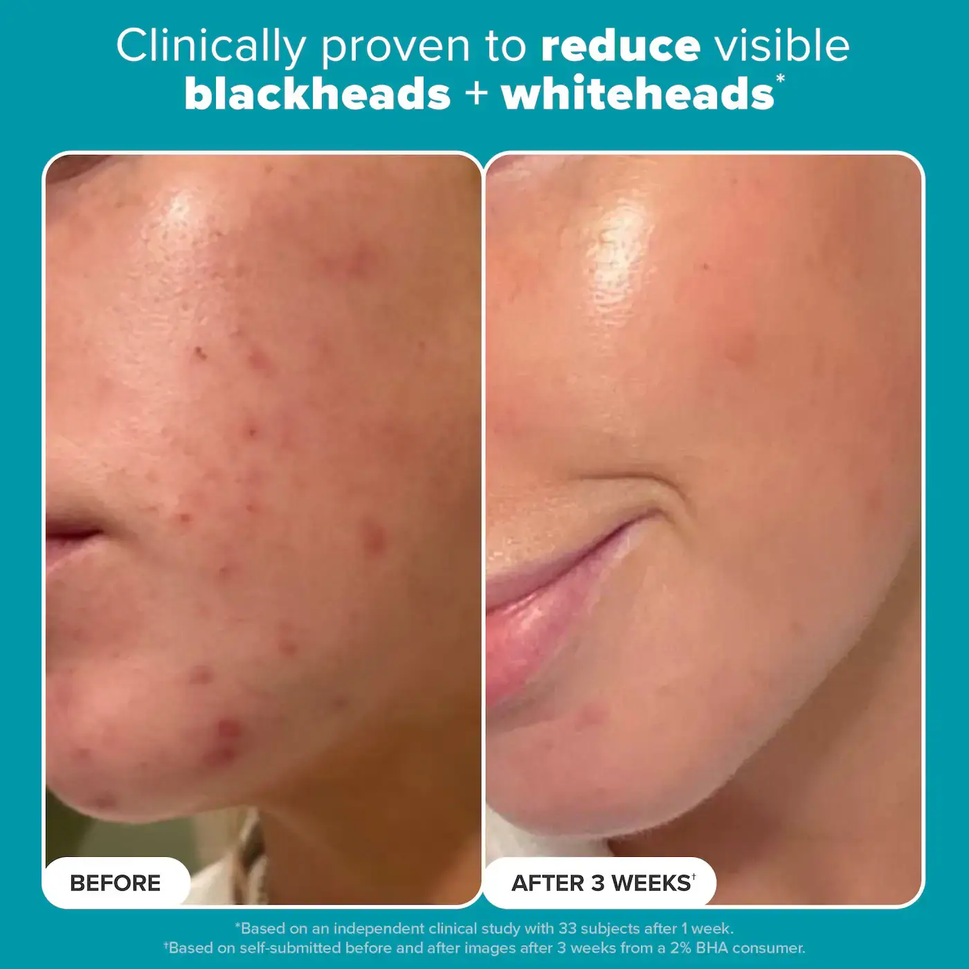 2% BHA Exfoliating Toner Pads - image 8