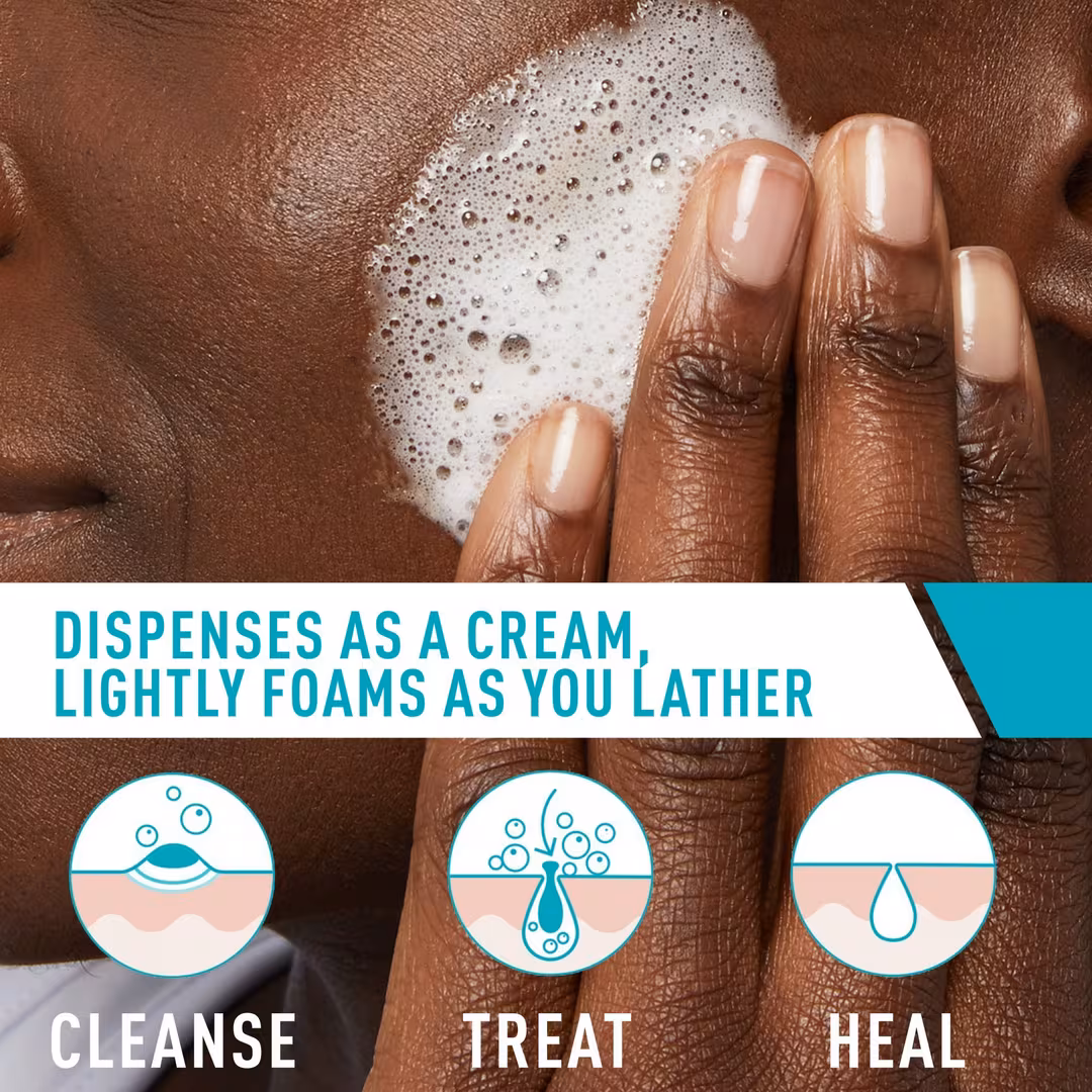 Acne Foaming Cream Cleanser - image 3