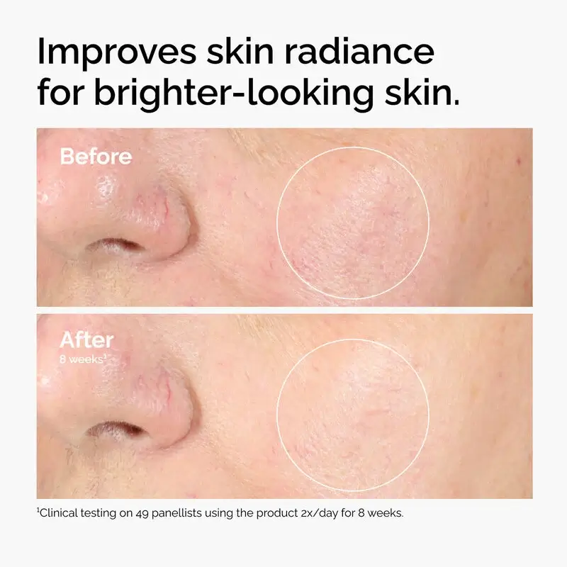 Alpha Arbutin 2% + HA  - image 4