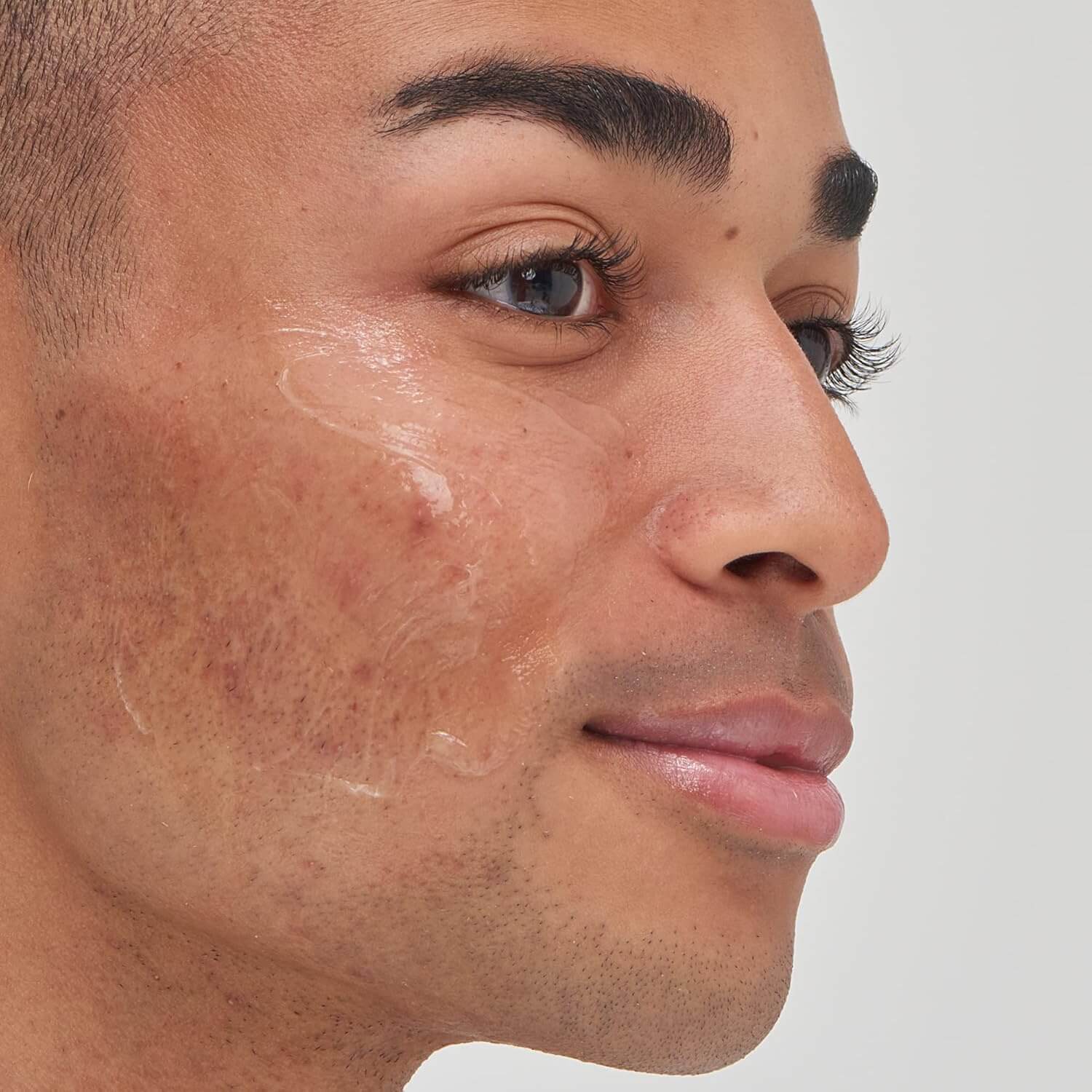 Tranexamic Acid Serum  - image 4