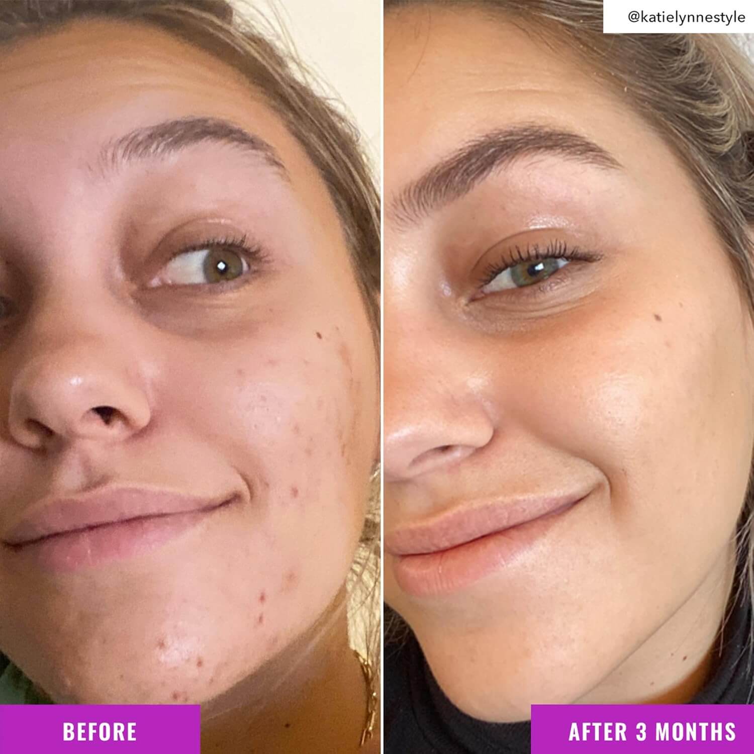 Niacinamide Brightening Toner  - image 5