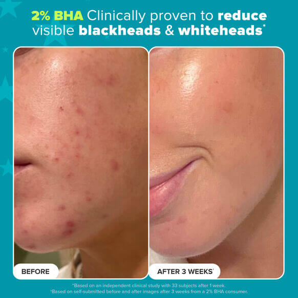 Smoothing Superstars - image 2