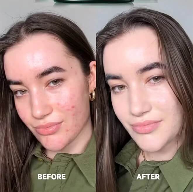 Cicapair Tiger Grass Color Correcting Treatment SPF22 - image 4