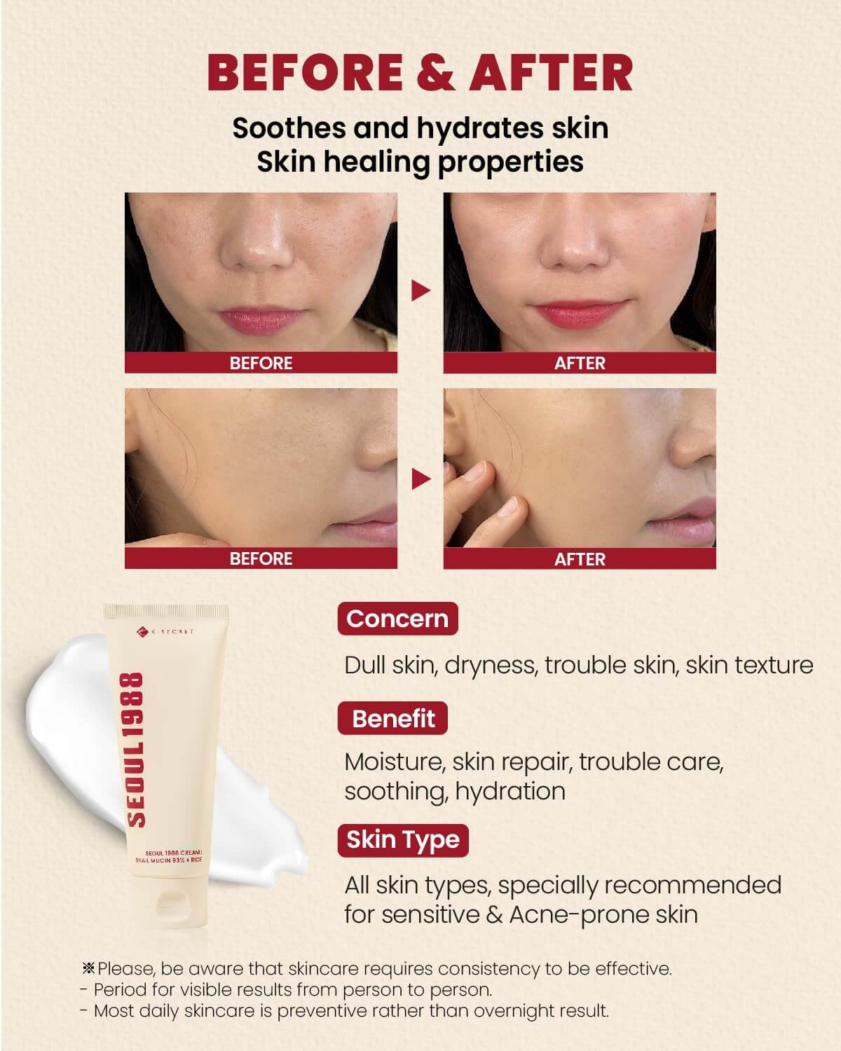 SEOUL 1988 Cream : Snail Mucin 93% + Rice - image 5
