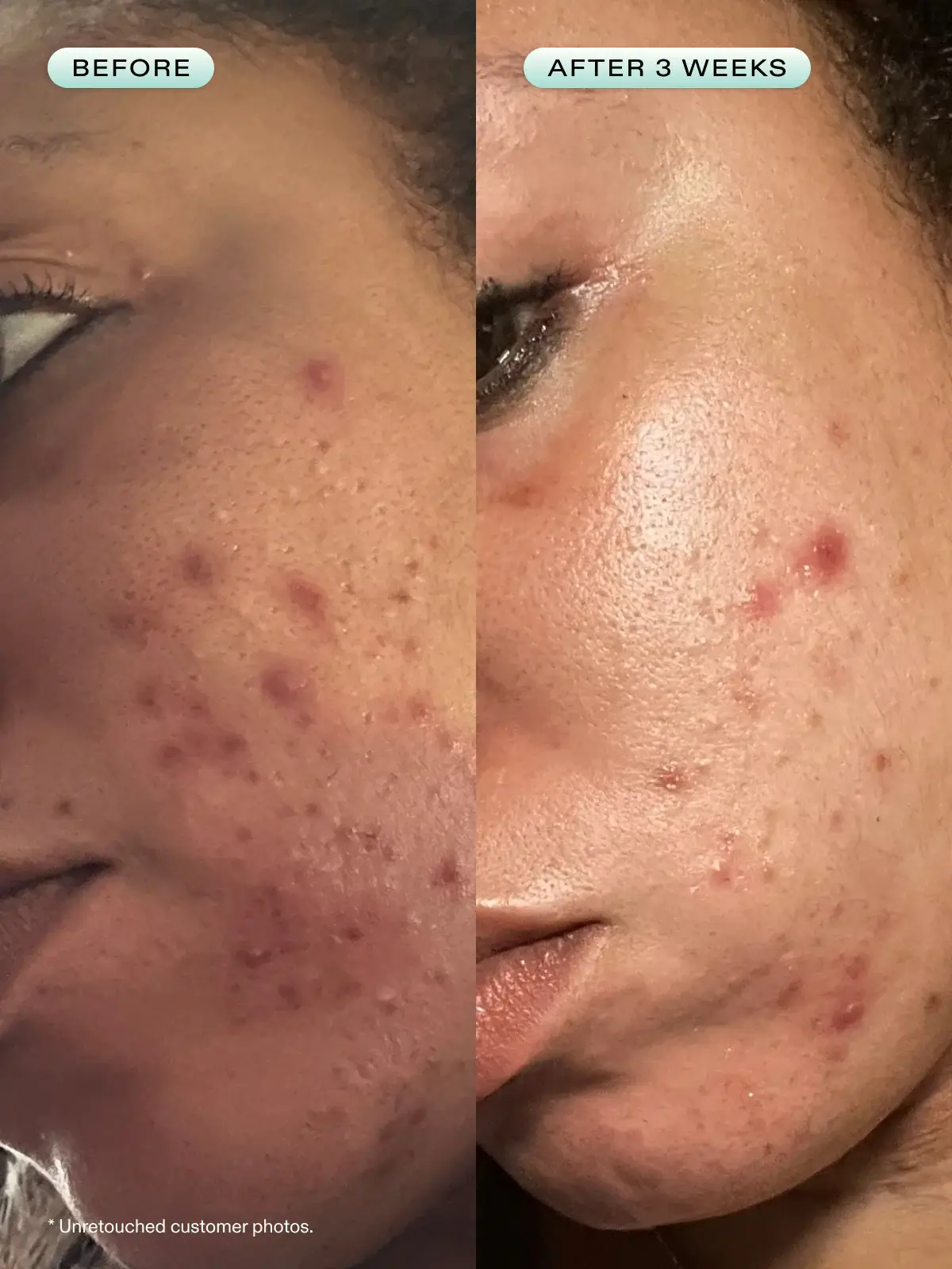 Great Barrier Relief  - image 5