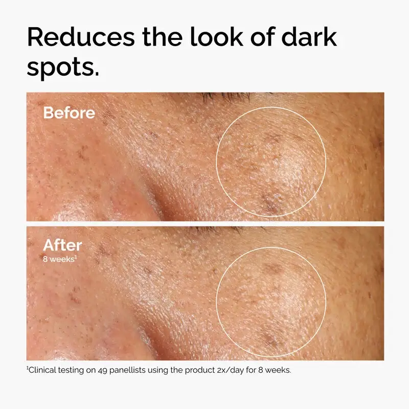 Alpha Arbutin 2% + HA  - image 5