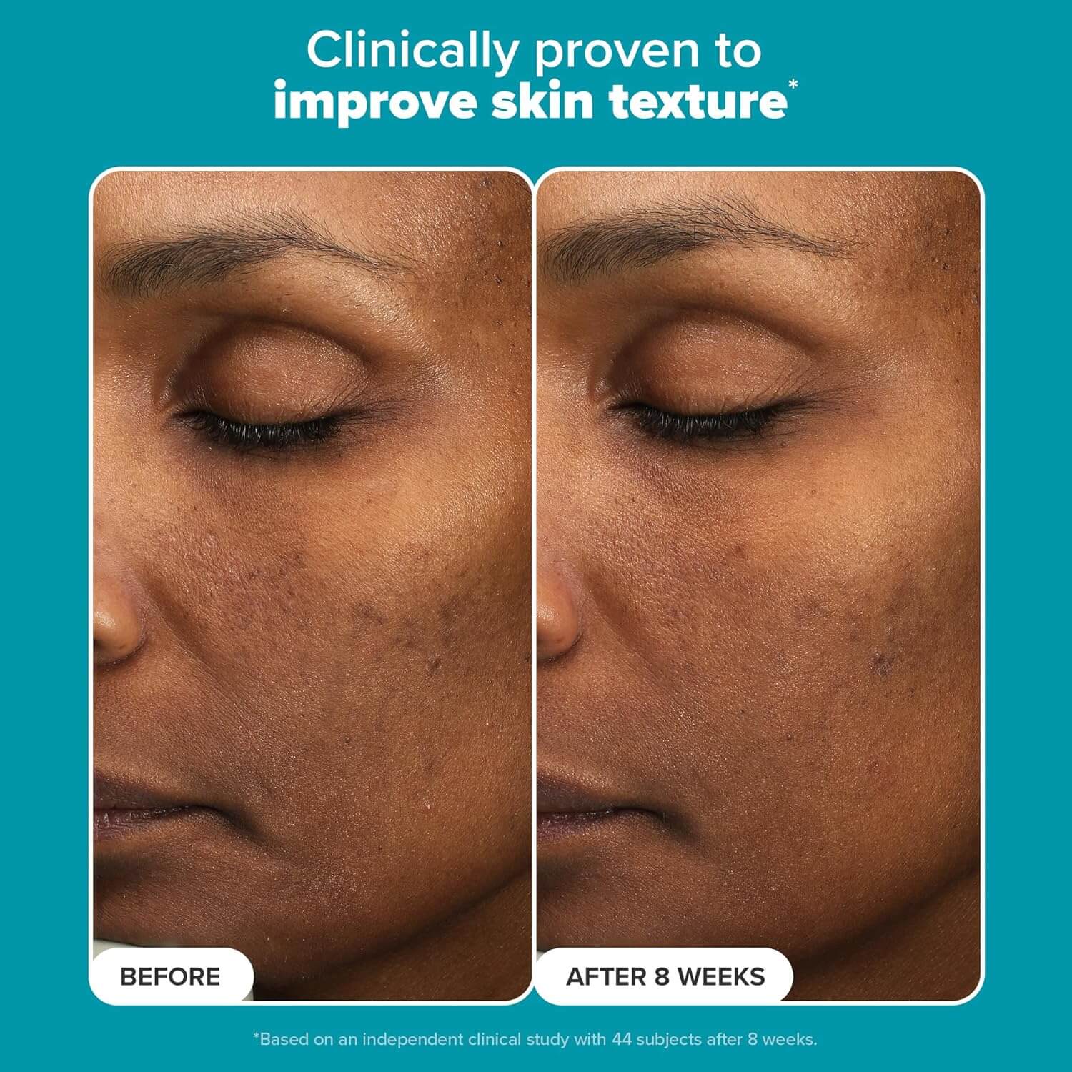 6% Mandelic + 2% Lactic Acid AHA Liquid Exfoliant - image 5