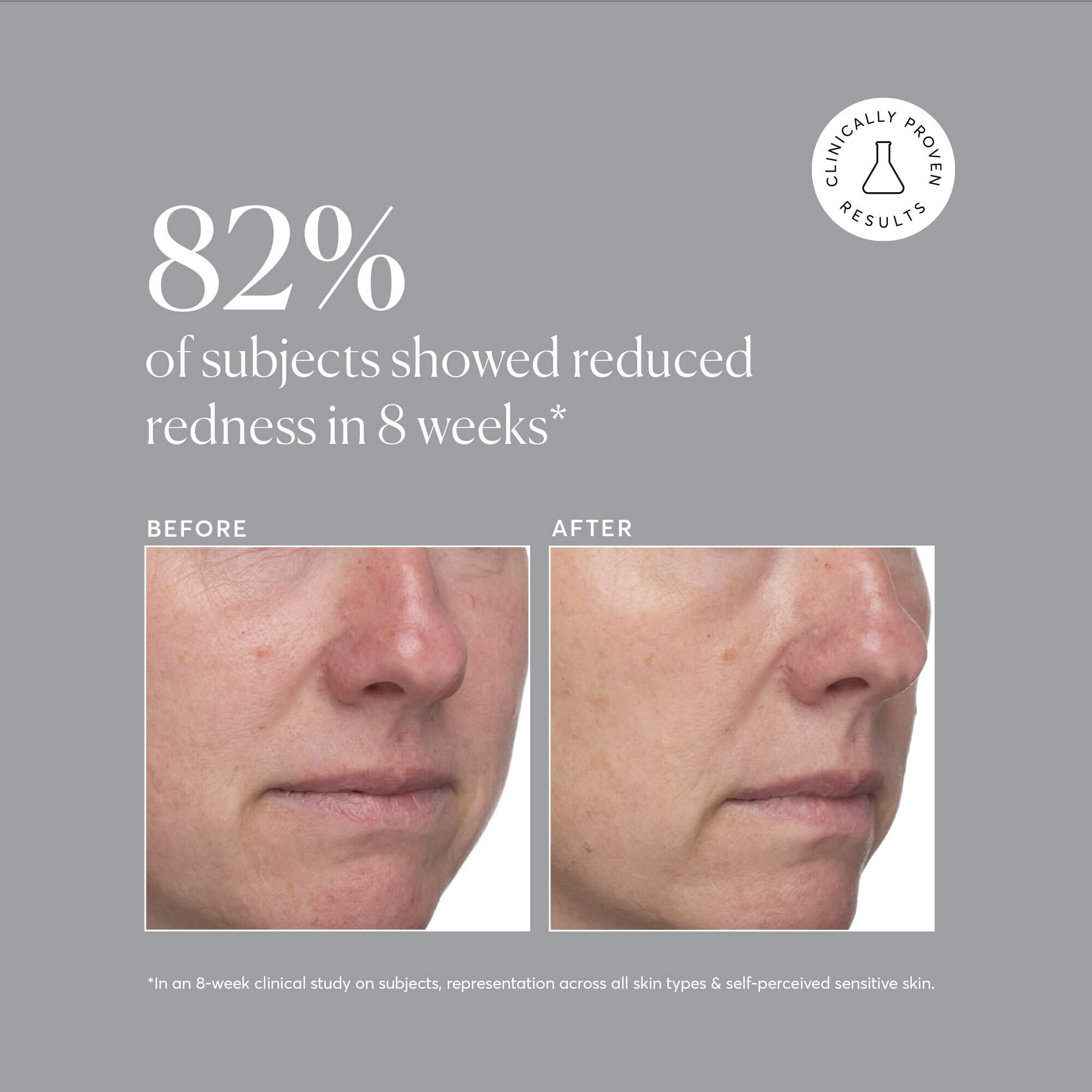 Azelaic Topical Acid 10% - image 9