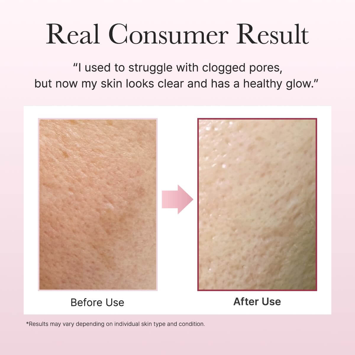 Fresh Rosehip Mochi Cleanser - image 6