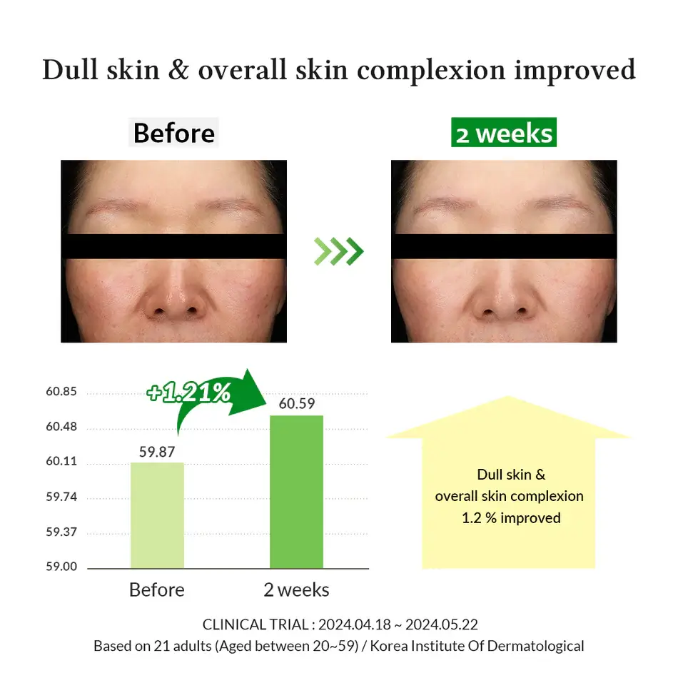 Gentle Vitamin C Serum - image 8