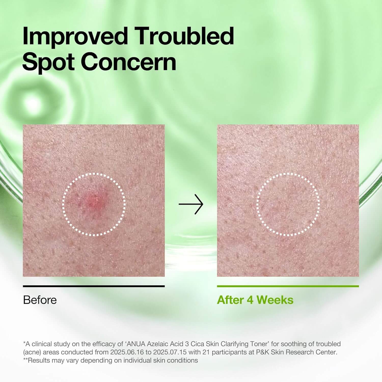 Azelaic 3 Cica Skin Clarifying Toner - image 6