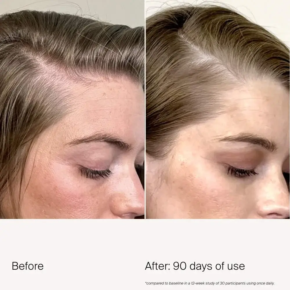 Scalp Care Density Serum - image 7