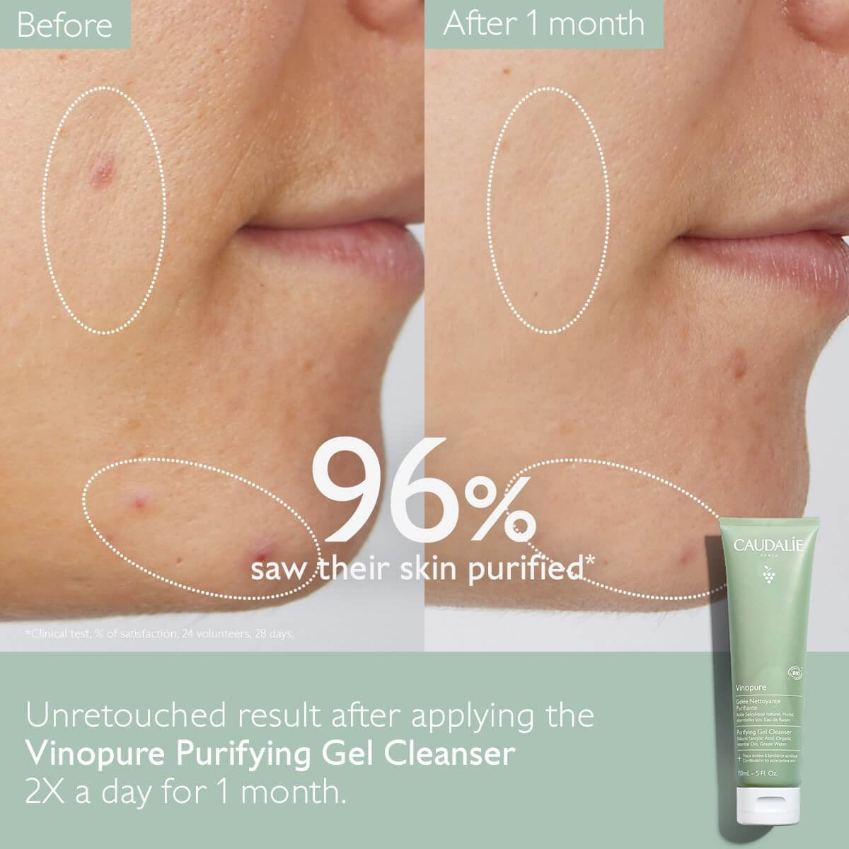 Vinopure Purifying Gel Cleanser - image 5